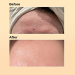 اسنس حلزون کوزارکس Cosrx - Image 4